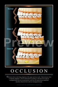 Occlusion Wall Chart